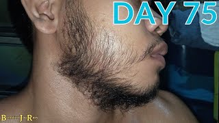 DAY 75  KIRKLAND MINOXIDIL BEARD JOURNEY [upl. by Ahc]