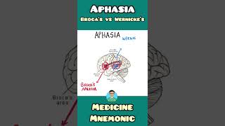 Brocas Aphasia VS Wernickes Aphasia  mnemonic  shorts [upl. by Alletsirhc]