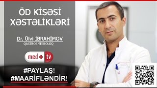 Od kisesi xestelikleri  Dr Ulvi IBRAHIMOV Qastroenteroloq MEDPLUS TV [upl. by Aynekal]