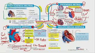2 MAPA MENTAL DE QX TÓRAX Y CV VALVULOPATÍAS [upl. by Ahsal]