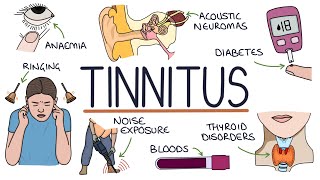 Understanding the Causes of Tinnitus [upl. by Adaha]