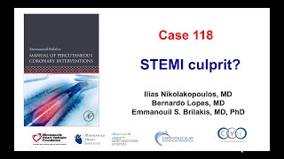 Case 118 PCI Manual  STEMI culprit [upl. by Grand]