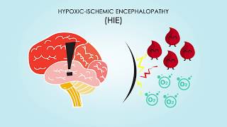 HypoxicIschemic Encephalopathy About Treatments amp Causes [upl. by Nazarius]