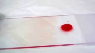 Geste technique  frottis sanguin  Blood smear [upl. by Ardel112]