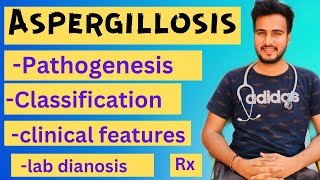 Aspergillosis microbiologymorphologypathogenesislabdiagnosisTreatment [upl. by Lazaruk]