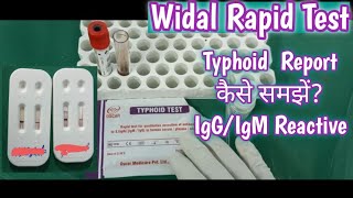 Widal Rapid Test  Typhoid Anitibodies detection Test  Widal Test Report [upl. by Hickey]