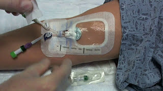 PICC Line Dressing Change with SorbaView Shield Dressing and BioPatch Disk [upl. by Onahpets]