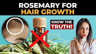 क्या Rosemary Oil Hair loss control करता है FAKE Claims 😨 Dr hc Palak Midha [upl. by Wichman]