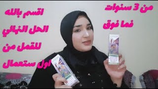 اقسم بالله الحل النهائي للقمل من اول استعمال لدى الاطفال والكبار اقوى واسرع علاج [upl. by Navnod]