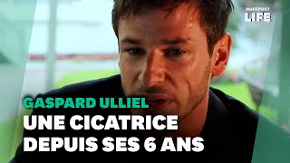 Gaspard Ulliel et sa cicatrice lhistoire derrière cette marque qui faisait quotpartie de luiquot [upl. by Ellerrehc]