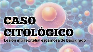 Lesión escamosa de bajo grado en citologia cervicovaginal [upl. by Buddie]