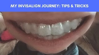 My Invisalign Journey Tips and Tricks [upl. by Chubb]