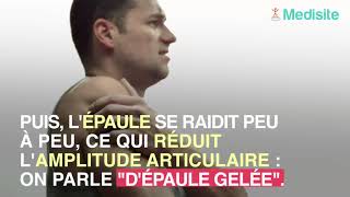 La capsulite de l’épaule peut révéler le diabète de type 2 [upl. by Dnarb158]