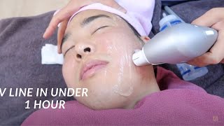 This Is What A NonSurgical Face Lift Looks Like  Seoul Guide Medical [upl. by Pul]