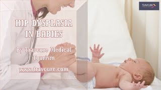 How to Identify Hip Dysplasia in Infants [upl. by Nylteak]