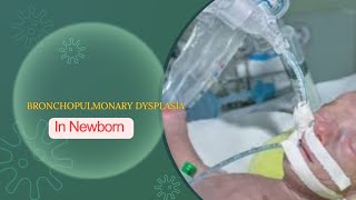 BRONCHOPULMONARY DYSPLASIA CHRONIC LUNG DISEASE  DEFINATION DR MEENA CHOUDHARY [upl. by Venterea114]