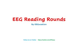 EEG Reading Rounds [upl. by Novert]