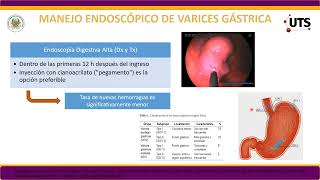 TELECAPACITACION MANEJO DE HEMORRAGIA VARICEAL [upl. by Ortrud]