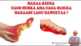 MAXAA KEENA CAGO HURKA AMA CAGA OLOLKA MAXAASE LAGU DAWEEYAA Dr faris [upl. by Ynatterb]