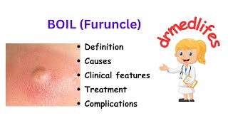 Boil furuncle definition causes clinical features treatment complications [upl. by Aloisius]