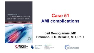 Case 51 PCI Manual  MI complications [upl. by Warde922]