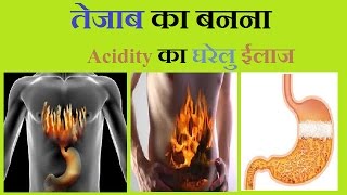 Acidity Problem  तेजाब बनना  बिना अंग्रेजी दवा के सरल उपाय  100 solution  होम Remedies [upl. by Seadon]