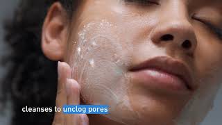 Clear Acne and Prevent New Breakouts │ CeraVe Skincare [upl. by Stephanus460]