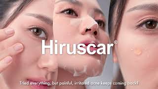 Hiruscar AntiAcne Advanced Spot Gel 15s [upl. by Nimsaj]