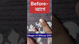 Magic of Silicea 200  ম্যাজিক অফ সিলিসিয়া 200shots youtubeshorts video shortvideo drsmondal [upl. by Ymer588]