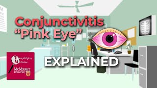 Conjunctivitis Pink Eye Explained [upl. by Ludie513]