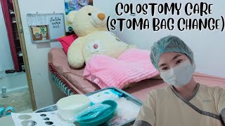 COLOSTOMY CARE STOMA BAG CHANGE RETURN DEMONSTRATION [upl. by Eelreveb175]