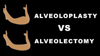 Alveoloplasty vs Alveolectomy [upl. by Michele181]