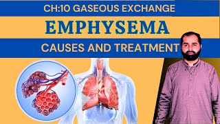 EmphysemaEmphysema Class 10 ChemistryPlusOfficial [upl. by Assyram244]