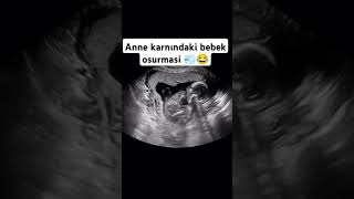 Farting of the baby in the 😂😂 Anne karnındaki bebeğin 😂😂 anne bebek shorts pişpişş [upl. by Aitnauq386]