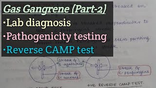 Gas gangrene Part2  Lab diagnosis  Pathogenicity testing  Reverse CAMP test [upl. by Strickman786]