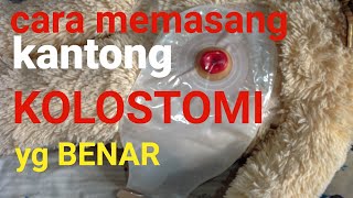 Cara memasang kantong kolostomi agar awet dan tidak mudah bocor [upl. by Anihsak14]