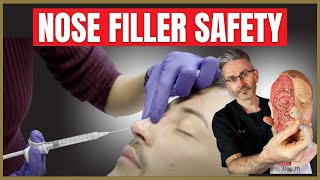 Nose Filler Safety  Liquid Rhinoplasty Injection Safety Advice [upl. by Akit]