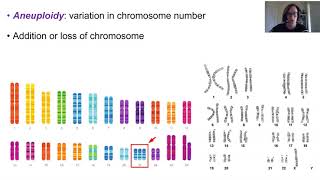 Chromosome abnormalities [upl. by Revell35]