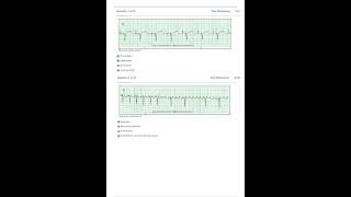 Relias Dysrhythmia Basic Test Answers 2023 Dysrhythmia – Basic A A GRADED 100 VERIFIED [upl. by Placida]