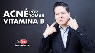 ¿La vitamina B produce acné  Dr Marino dermatólogo [upl. by Retxab]