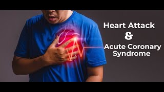 Acute Coronary Syndrome Dr Asore [upl. by Ahsekyt]