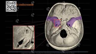 Hueso Esfenoides [upl. by Hamann982]