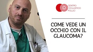 Come Vede un Occhio Con il Glaucoma [upl. by Saire]