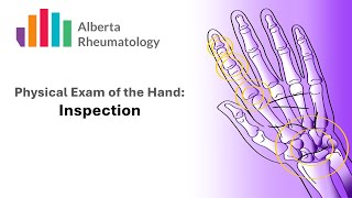 Rheumatology HAND exam Part 2 Inspection [upl. by Ayital]