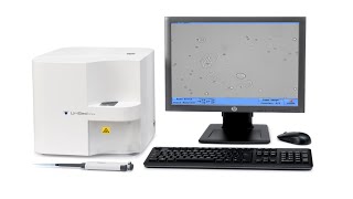 Urised Mini  77 Elektronika  Urine Microscopy [upl. by Perseus]