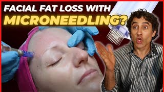 WILL MICRONEEDLING CAUSE YOUR FACIAL FAT LOSS and DAMAGE YOUR SKIN [upl. by Allemahs]