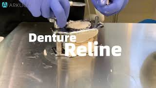 Denture reline [upl. by Sualkcin392]