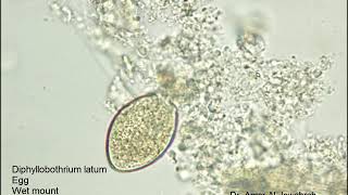 Diphyllobothrium latum egg [upl. by Bashee211]