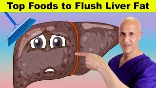 Top Foods to Flush Liver Fat  Dr Mandell [upl. by Arodnap]