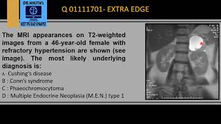 PHEOCHROMOCYTOMA MRI [upl. by Arrat879]